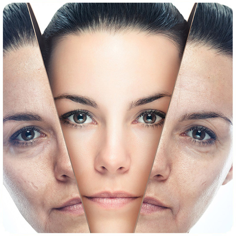 متدهای جوان سازی